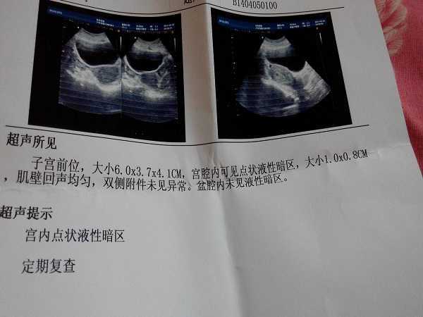 单身人士咨询生育问题前，先厘清的隐私、法律与医疗边界